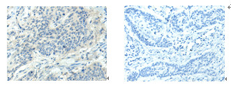 HTR2A Antibody in Immunohistochemistry (Paraffin) (IHC (P))