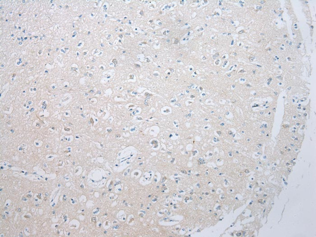 ADAMTS8 Antibody in Immunohistochemistry (Paraffin) (IHC (P))