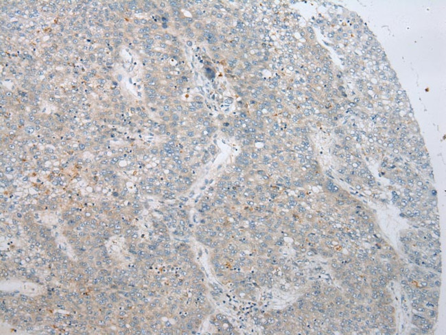 ADAMTS8 Antibody in Immunohistochemistry (Paraffin) (IHC (P))