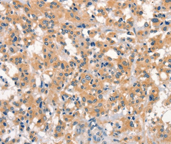 EID3 Antibody in Immunohistochemistry (Paraffin) (IHC (P))