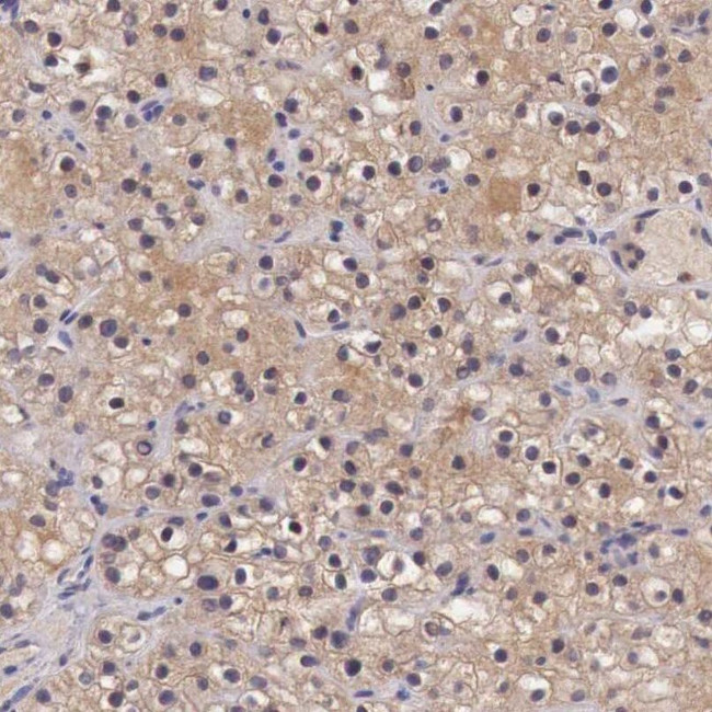 CHRDL1 Antibody in Immunohistochemistry (IHC)