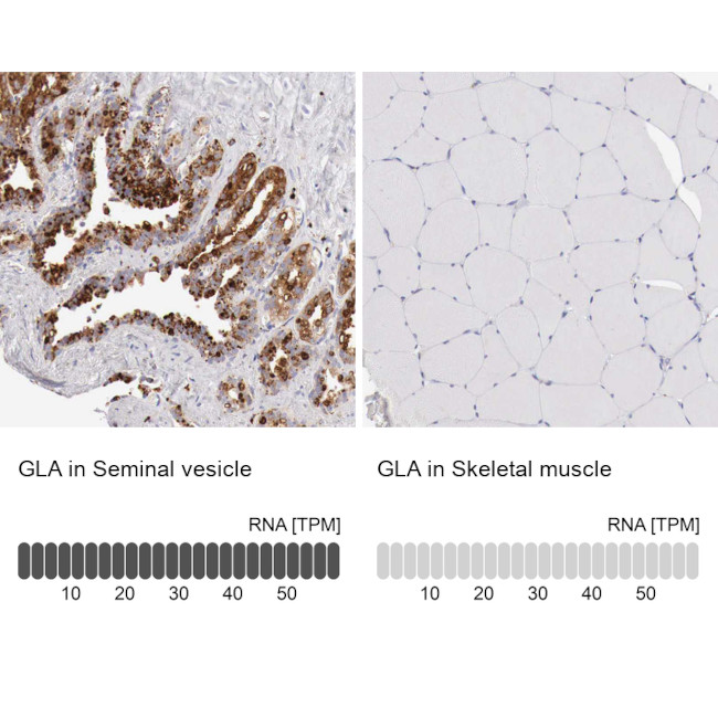 alpha Galactosidase Antibody in Immunohistochemistry (IHC)