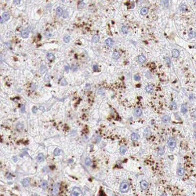 alpha Galactosidase Antibody in Immunohistochemistry (IHC)