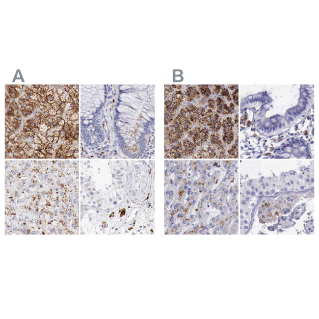 alpha Galactosidase Antibody in Immunohistochemistry (IHC)