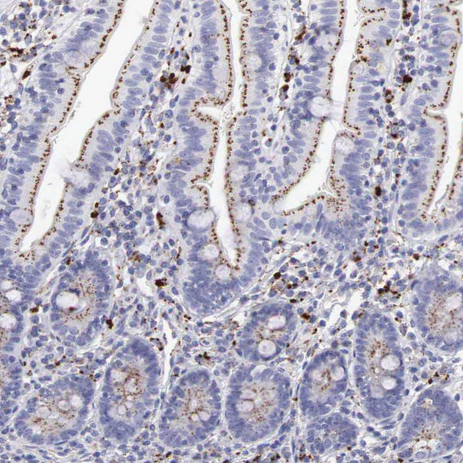 alpha Galactosidase Antibody in Immunohistochemistry (IHC)