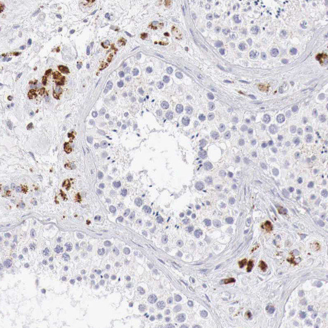 alpha Galactosidase Antibody in Immunohistochemistry (IHC)