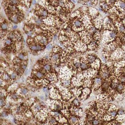 alpha Galactosidase Antibody in Immunohistochemistry (IHC)