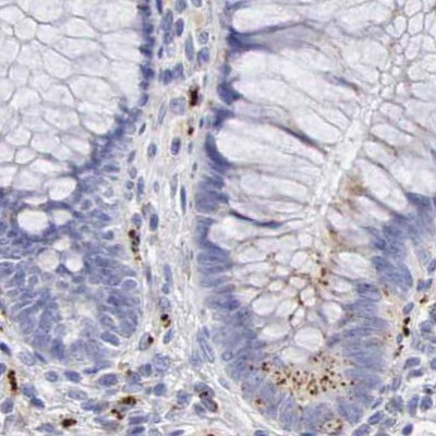 alpha Galactosidase Antibody in Immunohistochemistry (IHC)