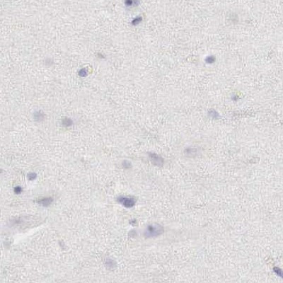 OTC Antibody in Immunohistochemistry (IHC)