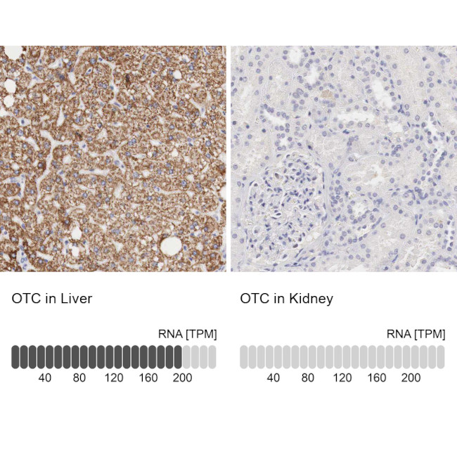 OTC Antibody