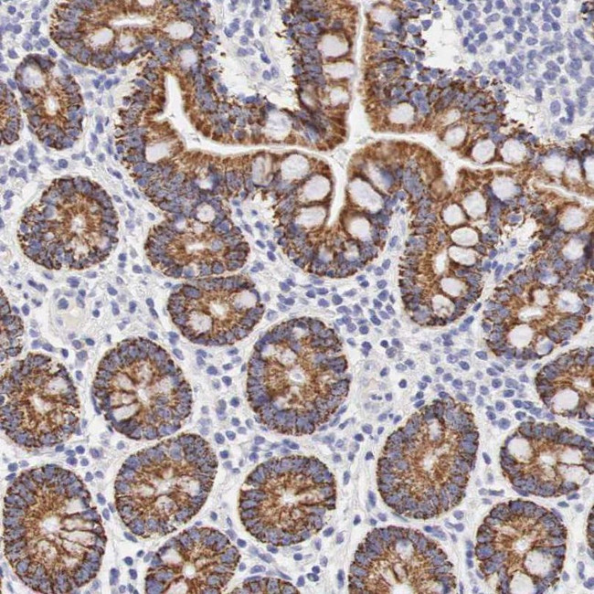 OTC Antibody in Immunohistochemistry (IHC)