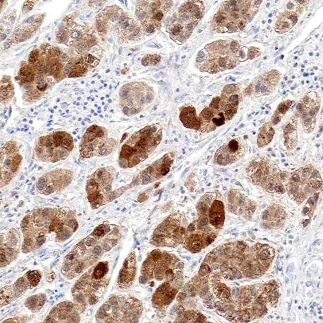 OTC Antibody in Immunohistochemistry (IHC)