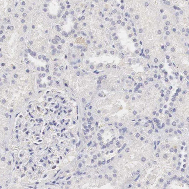 OTC Antibody in Immunohistochemistry (IHC)