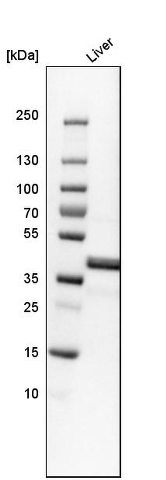 OTC Antibody in Western Blot (WB)