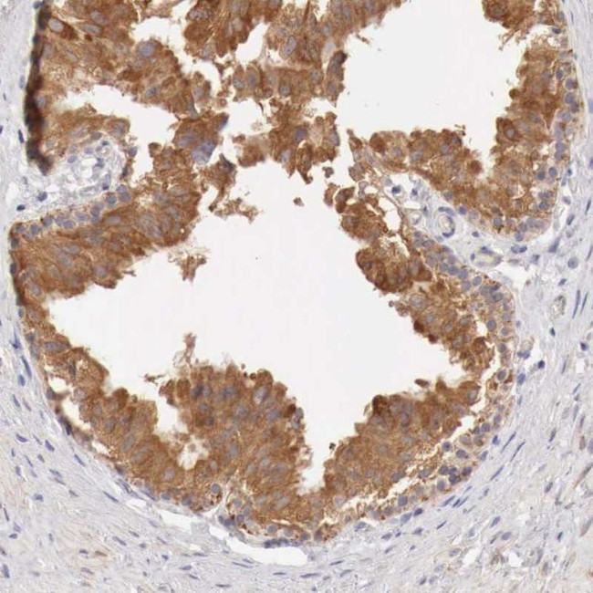 NSDHL Antibody in Immunohistochemistry (IHC)