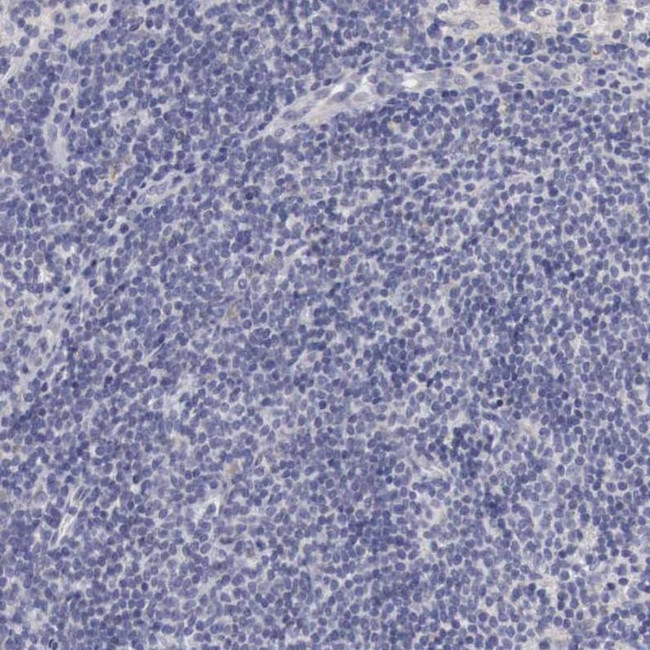 NSDHL Antibody in Immunohistochemistry (IHC)