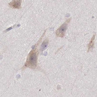 NSDHL Antibody in Immunohistochemistry (IHC)