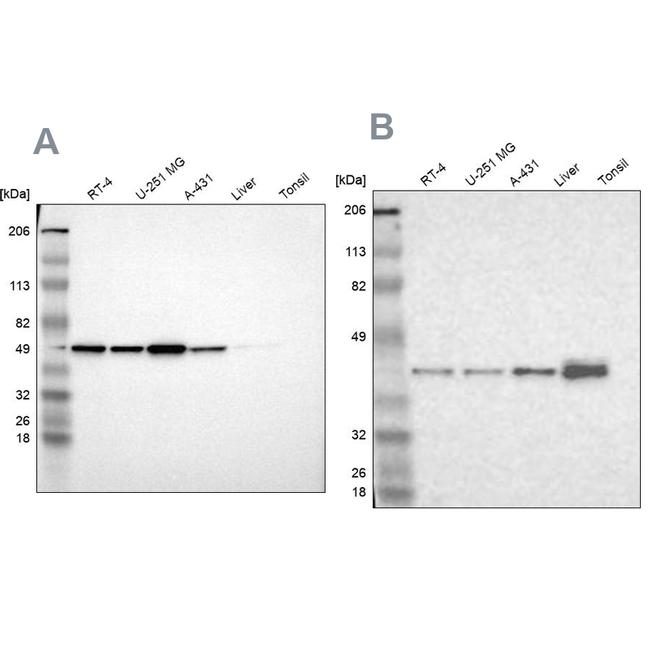 NSDHL Antibody in Western Blot (WB)