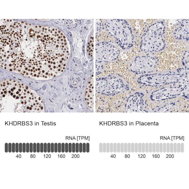 KHDRBS3 Antibody in Immunohistochemistry (IHC)