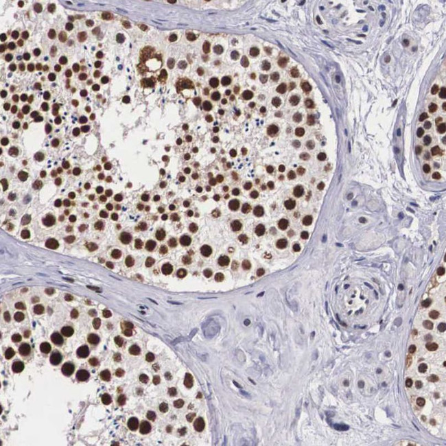 KHDRBS3 Antibody in Immunohistochemistry (IHC)