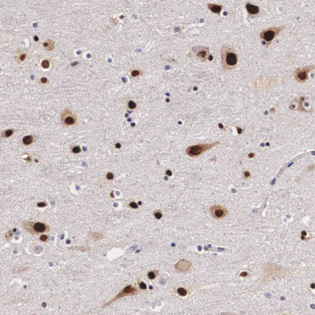 KHDRBS3 Antibody in Immunohistochemistry (IHC)