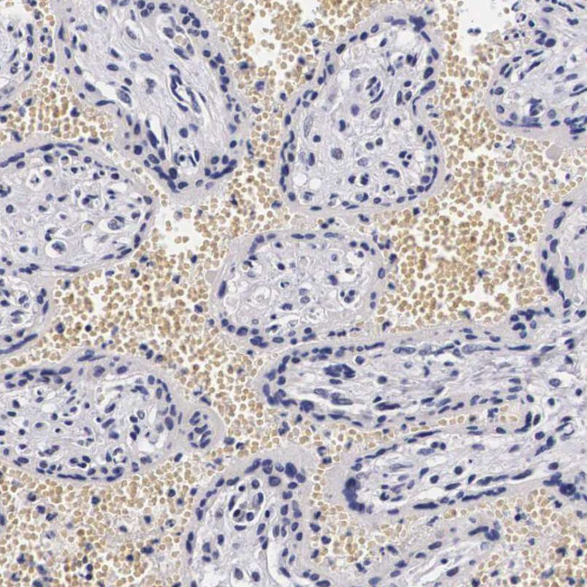 KHDRBS3 Antibody in Immunohistochemistry (IHC)