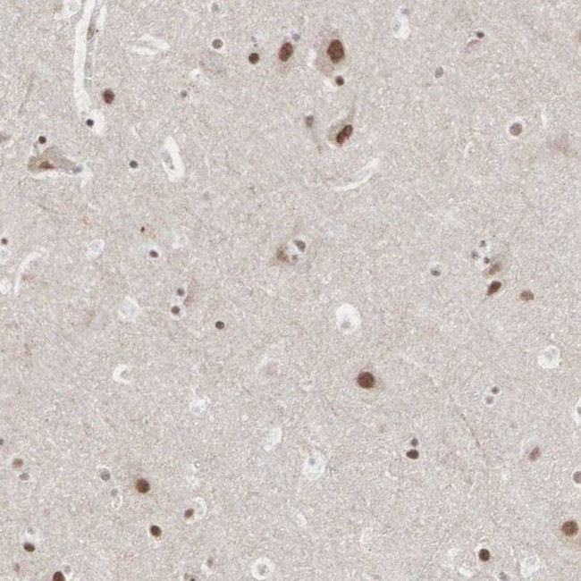 AUTS2 Antibody in Immunohistochemistry (IHC)