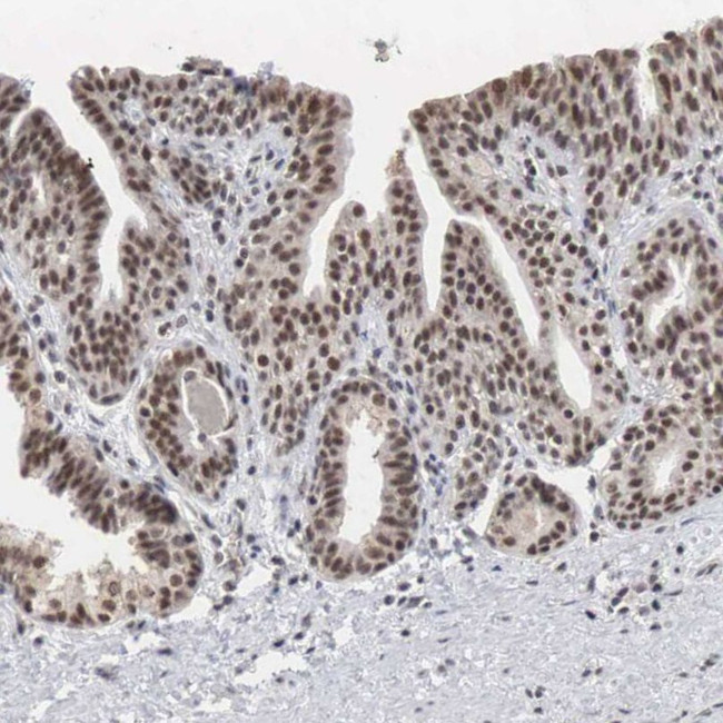 AUTS2 Antibody in Immunohistochemistry (IHC)