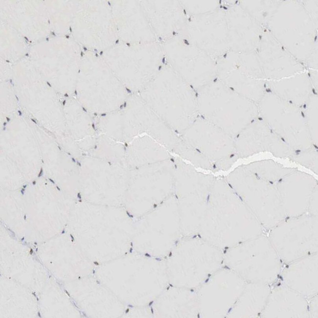 AUTS2 Antibody in Immunohistochemistry (IHC)