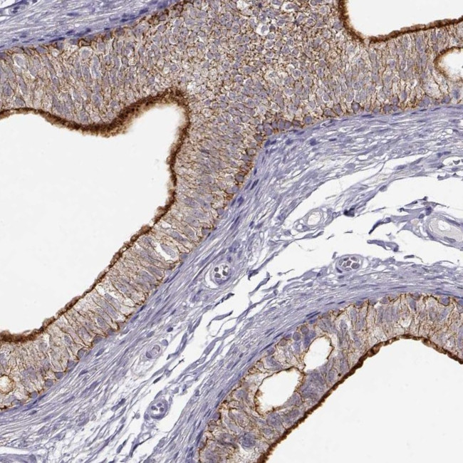 ZNF185 Antibody in Immunohistochemistry (IHC)