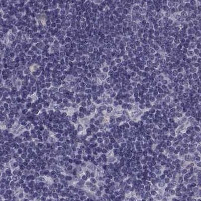 ZNF185 Antibody in Immunohistochemistry (IHC)