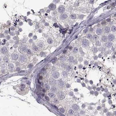 ZNF185 Antibody in Immunohistochemistry (IHC)