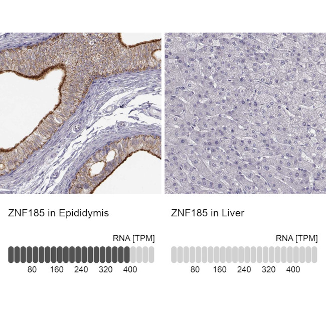 ZNF185 Antibody