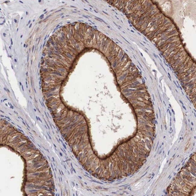 ZNF185 Antibody in Immunohistochemistry (IHC)