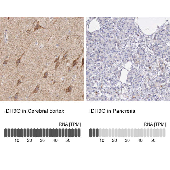 IDH3G Antibody in Immunohistochemistry (IHC)