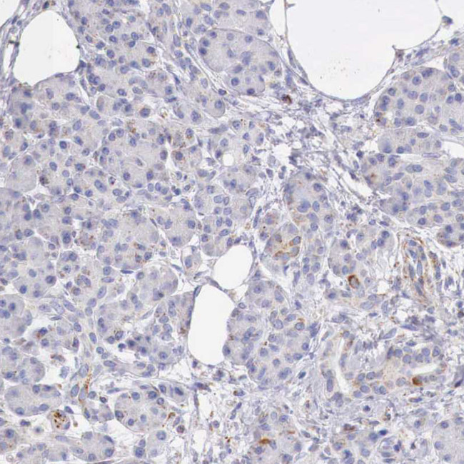 IDH3G Antibody in Immunohistochemistry (IHC)