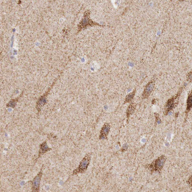 IDH3G Antibody in Immunohistochemistry (IHC)