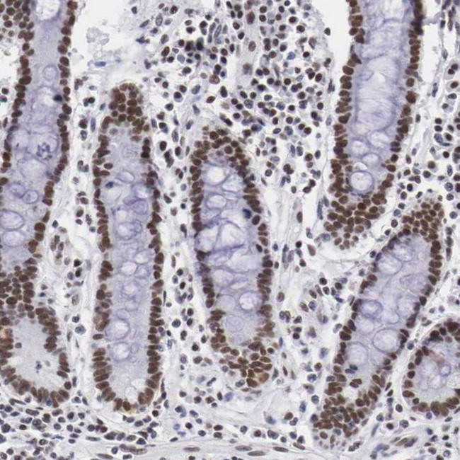 CSTF2 Antibody in Immunohistochemistry (IHC)