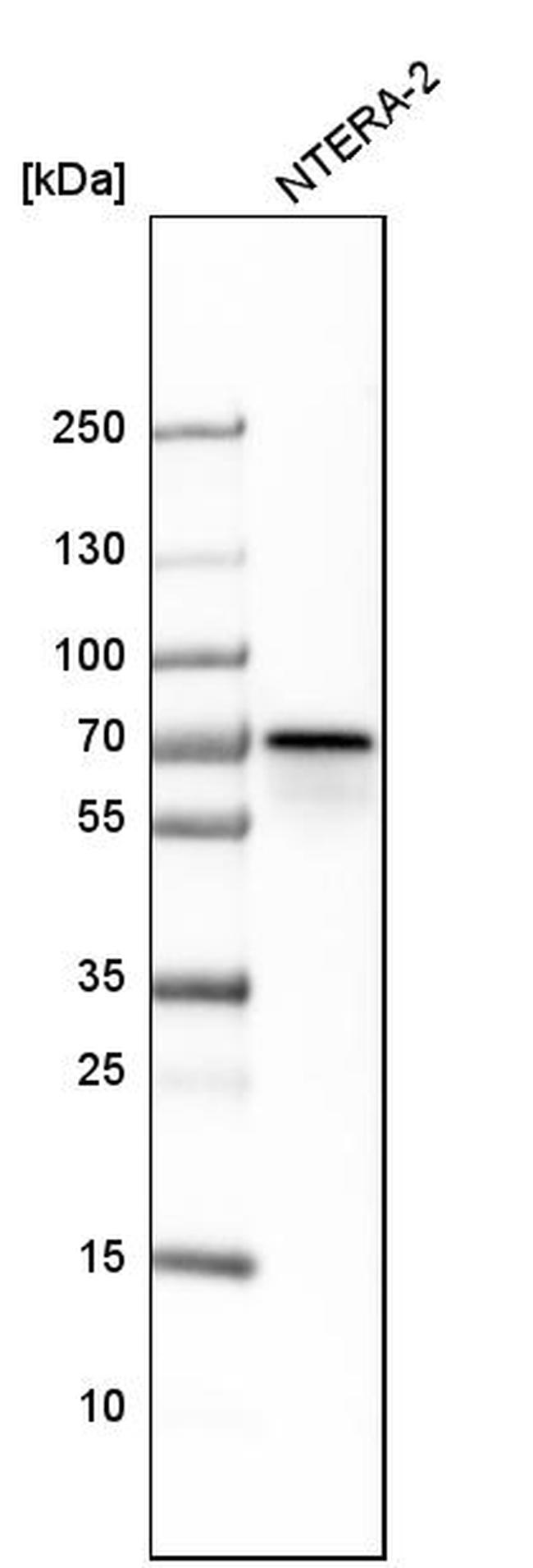 CSTF2 Antibody in Western Blot (WB)