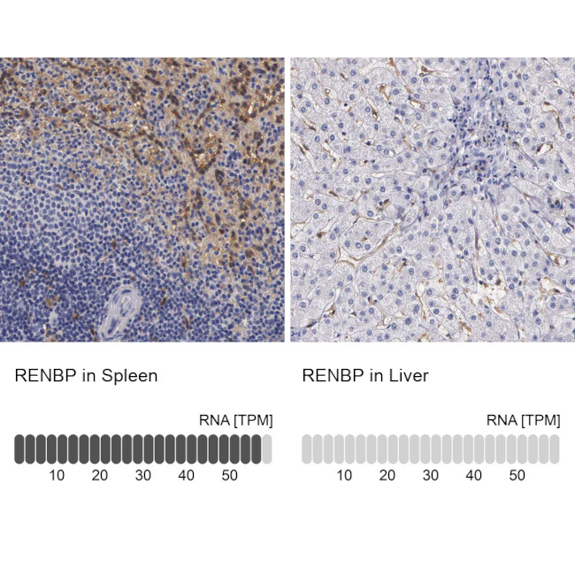 RENBP Antibody in Immunohistochemistry (IHC)