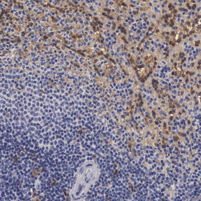 RENBP Antibody in Immunohistochemistry (IHC)