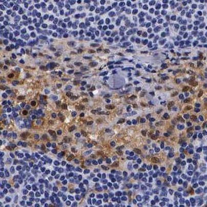 RENBP Antibody in Immunohistochemistry (IHC)