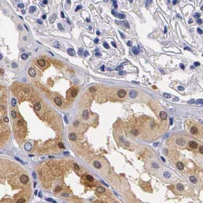 RENBP Antibody in Immunohistochemistry (IHC)