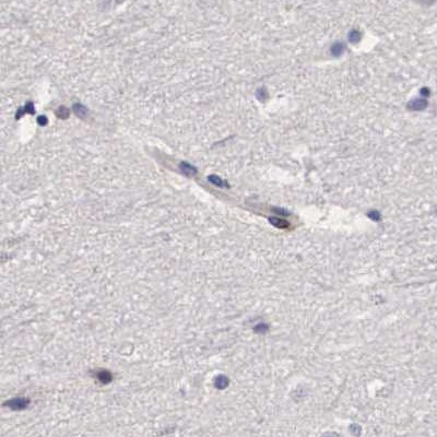 RENBP Antibody in Immunohistochemistry (IHC)