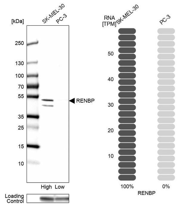 RENBP Antibody in Western Blot (WB)