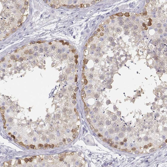 TKTL1 Antibody in Immunohistochemistry (IHC)