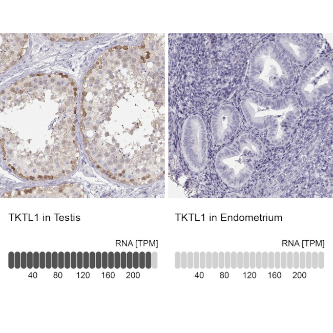 TKTL1 Antibody