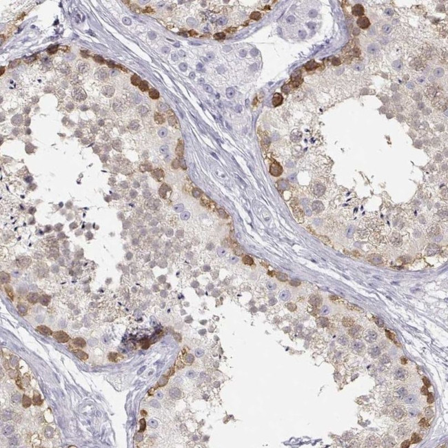 TKTL1 Antibody in Immunohistochemistry (IHC)