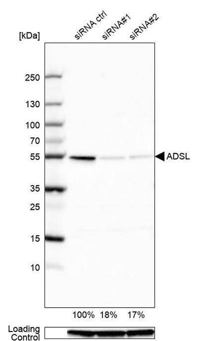 ADSL Antibody