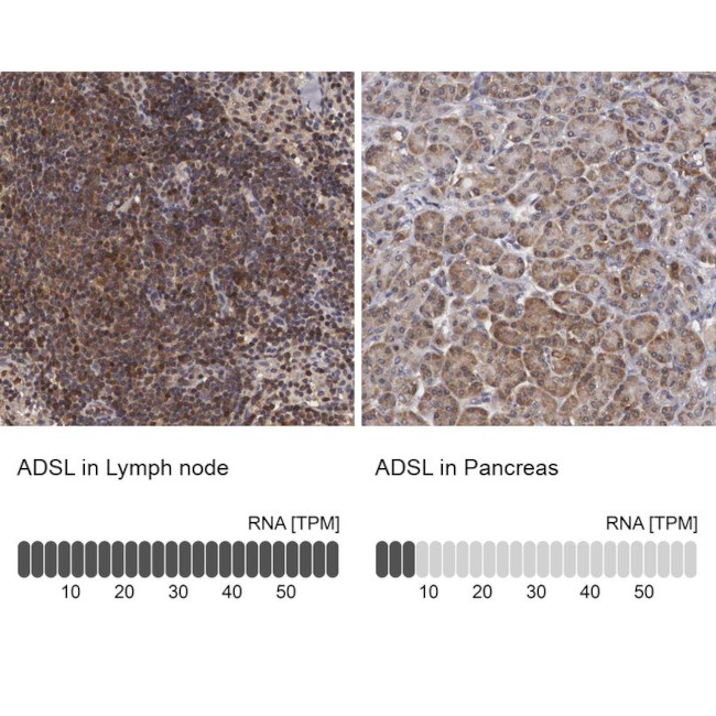 ADSL Antibody in Immunohistochemistry (IHC)